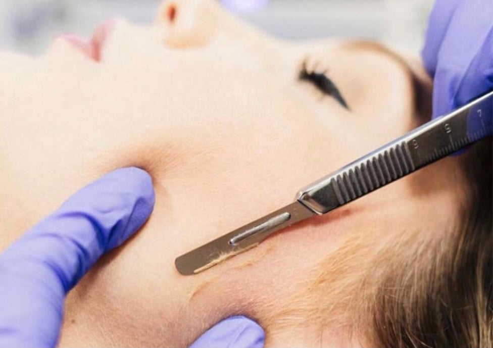 Dermaplaning facial